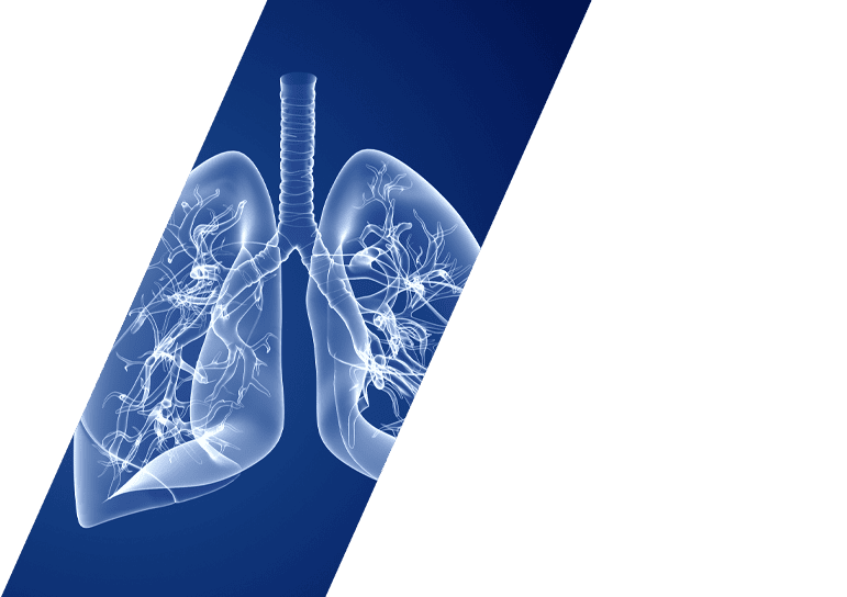model of lungs - Pulmonary Rehab